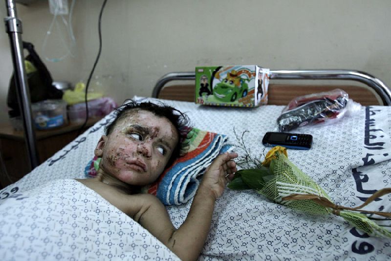 On 12 August, 18-month-old Mohammed Ali Wahdan lies on a cot in the paediatric ward of Al-Shifa Hospital, in Gaza. He is recovering from burns and injuries he sustained during a blast that reportedly killed 12 members of his family, including his mother. Photo: UNICEF/NYHQ2014-1159/El Baba<br />