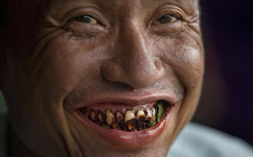  In this Friday, June 3, 2016 photo, a habitual " kun-ya" eater with some betel leaves in his mouth smiles in Yangon, Myanmar. Photo: Gemunu Amarasinghe / Associated Press  