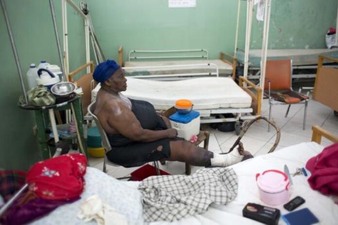 In this July 19, 2016 photo, patient Penina Pierre sits alone in a dermatology ward, her bandaged foot propped on a chair, at the Hospital of the State University of Haiti, in Port-au-Prince. Photo: Dieu Nalio Chery