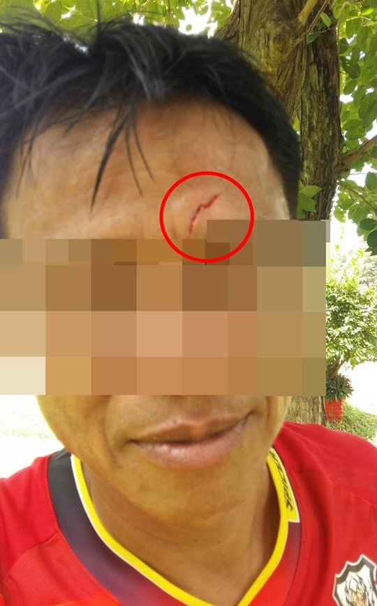 One police officer appears to have suffered a cut on his face from an inter-departmental football match Wednesday in Sakon Nakhon province.
