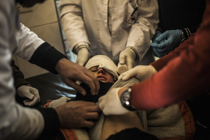 Yousuf Odey, 10, wounded in the eye by Islamic State militants is treated by doctors at a clinic in Zahra district in Mosul, Iraq on Dec. 7, 2016. Photo: Manu Brabo / AP.