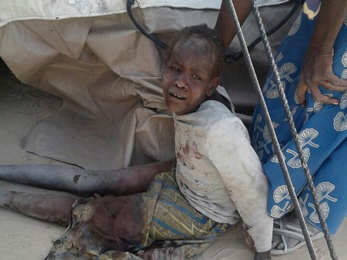 A child lays wounded after a military sir strike on a camp for displaced people Tuesday in Rann, Nigeria. Photo: Associated Press