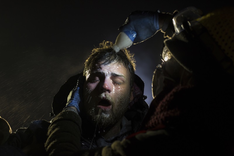 "Standing Rock" by photographer Amber Bracken which won first prize in the Contemporary Issues, Stories, category of the World Press Photo contest shows a man who is treated with milk of magnesia after being pepper sprayed by police at the blockade on highway 1806. Photo: Amber Bracken / Associated Press