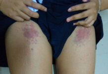 Freshman Forced to Sing, Slap Self Until Bruised in Uni Hazing Ritual
