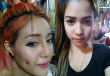 Dimple-Piercing Fad Nothing to Smile About, Doctors Warn