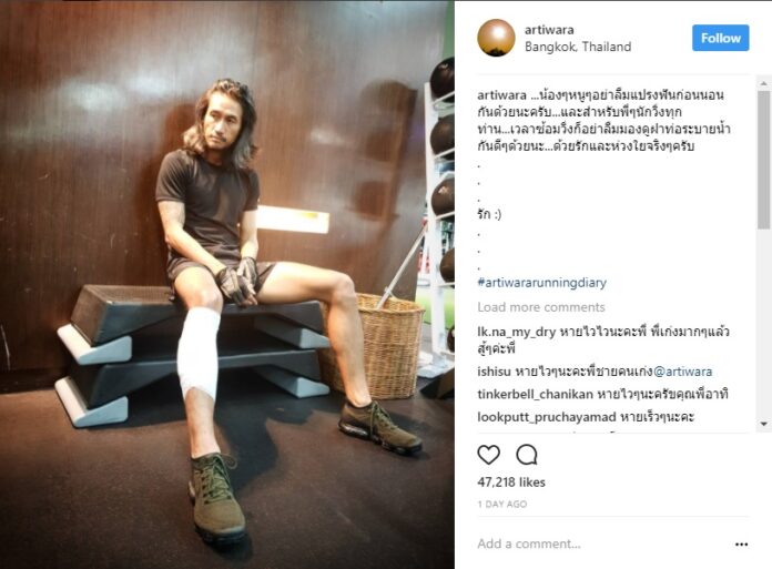 Singer Artiwara ‘Toon’ Kongmalai posts a photo of himself appears to be injured on his leg to his Instagram account Thursday.