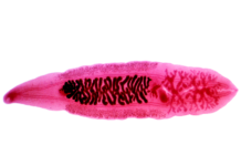 Study Shows Parasite From Vietnam May Be Killing US Veterans