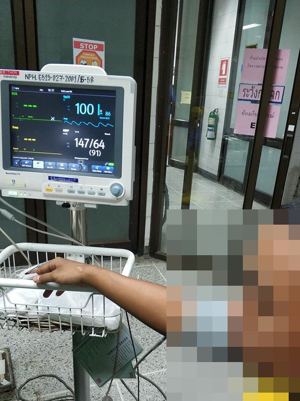 A student who was rushed to the hospital after being hazed at the Rajamangala University of Technology Lanna.