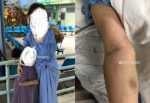 Chinese Tourist Loses Arm in Sobering Reminder of Thai Road Safety Photos: 单翼的花精灵 / Weibo