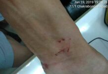 Counterprotesters Deny Assaulting Pro-Democracy Activist