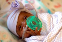 Girl Believed to Be Tiniest Newborn Weighed as Much as Apple This March, 2019 photo provided by Sharp HealthCare in San Diego shows a baby named Saybie. Sharp Mary Birch Hospital for Women & Newborns said in a statement Wednesday, May 29, 2019, that Saybie, born at 23 weeks and three days, is believed to be the world's tiniest surviving baby, who weighed just 245 grams (about 8.6 ounces) before she was discharged as a healthy infant. Photo: Sharp HealthCare via AP