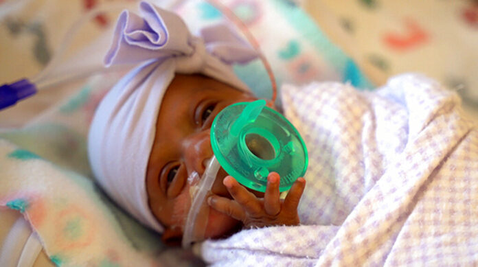 This March, 2019 photo provided by Sharp HealthCare in San Diego shows a baby named Saybie. Sharp Mary Birch Hospital for Women & Newborns said in a statement Wednesday, May 29, 2019, that Saybie, born at 23 weeks and three days, is believed to be the world's tiniest surviving baby, who weighed just 245 grams (about 8.6 ounces) before she was discharged as a healthy infant. Photo: Sharp HealthCare via AP