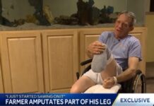 Farmer Cuts Off Trapped Leg Using Pocket Knife