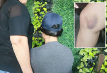 Beaten Up, Used as Mosquito Buffet: Freshman Spills on Latest SOTUS Hazing Freshman daughter, center, with her mom Wednesday in Suphanburi. Insert: one of her bruises.