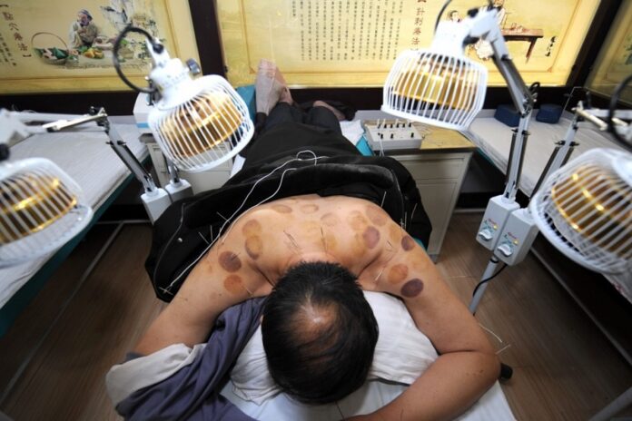A man receives acupuncture treatment at a hospital in Wuwei, northwest China’s Gansu province. Fil photo: Xinhua