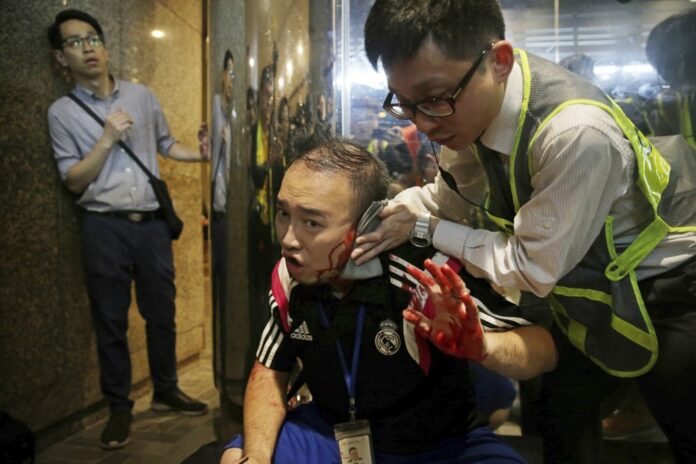 District councilor Andrew Chiu receives medical treatment in Hong Kong, on Sunday, Nov. 3, 2019. (Elson Li/HK01 via AP)