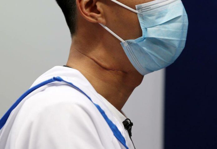 Hong Kong police officer Alex recalls neck-slash attack to him on Nov. 27, 2019 in south China's Hong Kong. After surgery, he still needs to undergo speech therapy for at least six months and may suffer permanent damage to his voice. Photo: Xinhua
