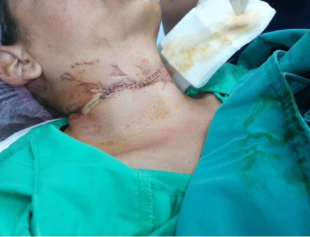 The wound on Christina Serma Gandia's throat.