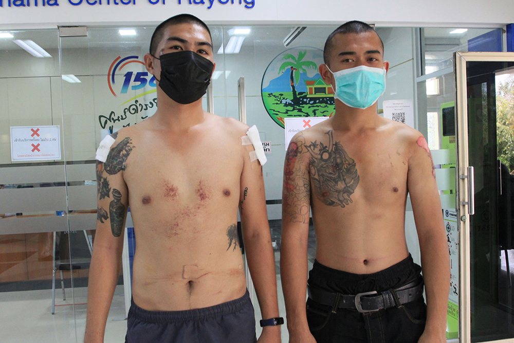 Pvt. Watchara Sirirak and Pvt. Kajorn Prachong show their bruises to reporters on Jan. 25, 2021.