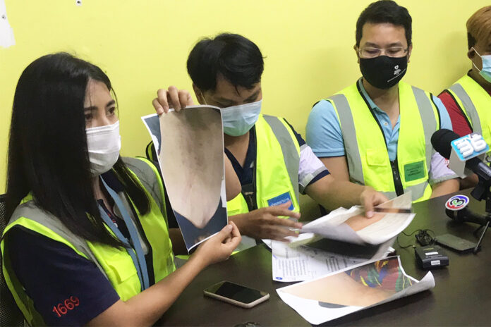 Toon, a leader of the Doctor and Nurse Association, shows a photo of a bruise found on Purapon’s body during a news conference held at the Thai Lawyers for Human Rights office on Feb. 17, 2021.