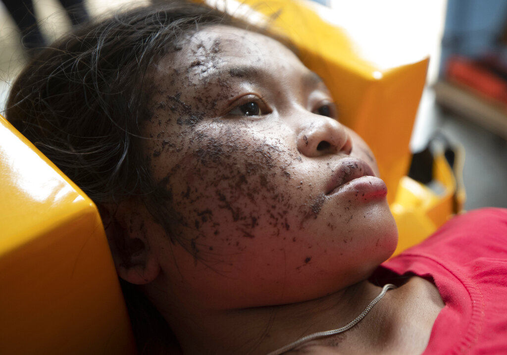 An injured ethnic Karen villager from Myanmar rests as she is treated after crossing the Salawin river via boat at Ban Mae Sam Laep Health Center, Mae Hong Son province, Thailand on Tuesday March 30, 2021. Photo: Sakchai Lalit / AP