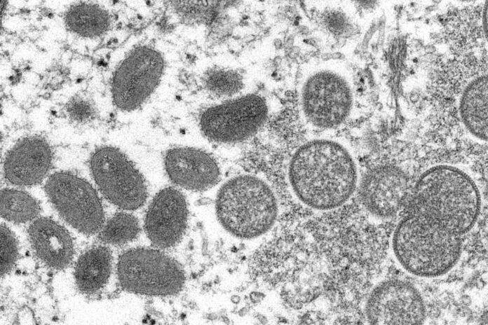 FILE - This 2003 electron microscope image made available by the Centers for Disease Control and Prevention shows mature, oval-shaped monkeypox virions, left, and spherical immature virions, right, obtained from a sample of human skin associated with the 2003 prairie dog outbreak. Photo: Cynthia S. Goldsmith, Russell Regner / CDC via AP File