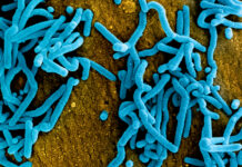 World Health Organization Declares Marburg Outbreak in Ghana A colorized scanning electron micrograph of Marburg virus particles. Photo: National Institute of Allergy and Infectious Diseases via Wikimedia Commons
