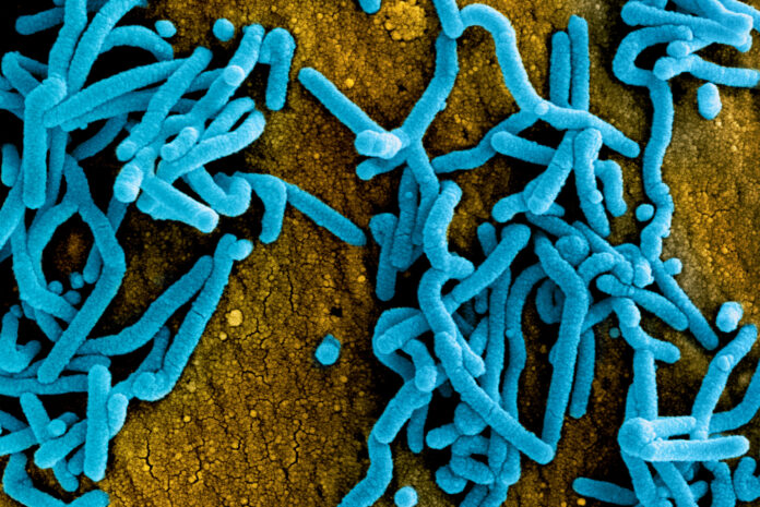 A colorized scanning electron micrograph of Marburg virus particles. Photo: National Institute of Allergy and Infectious Diseases via Wikimedia Commons