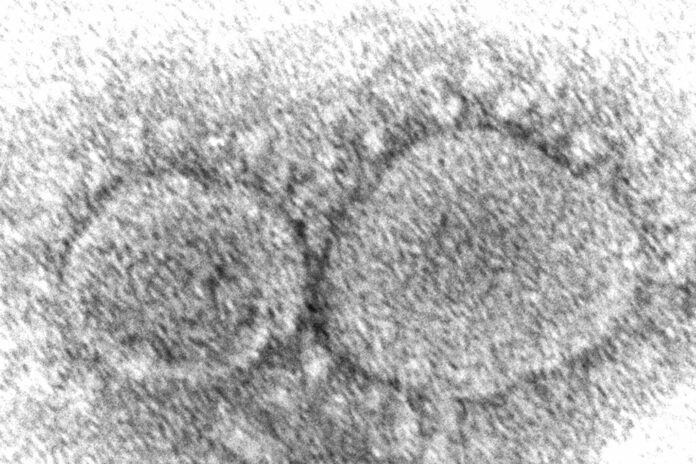 Virus Outbreak Origins Explainer