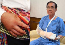 PM Gen. Prayut Is Admitted to the Hospital