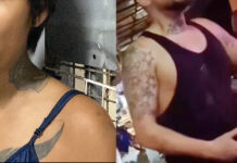 Pattaya Bar Employee Seeks Compensation After Assault by Foreign Man