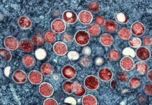 European Traveler Confirmed as Bringing New Mpox Strain to Thailand