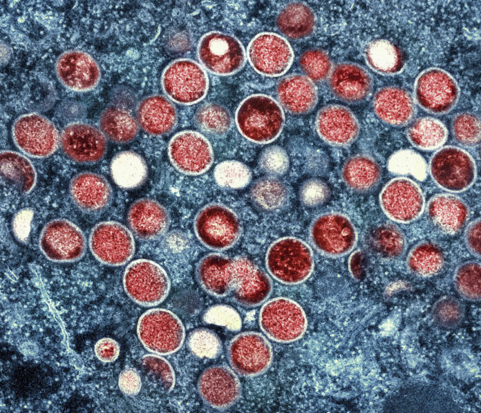 MED WHO Mpox