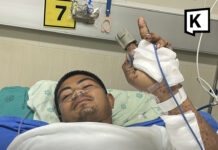 Soldier stable after emergency surgery for landmine injuries Soldier stable after emergency surgery for landmine injuries