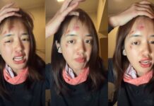 YouTuber Pigkaploy shows bruised face after Antarctic adventure: “Not a filter, real pain”