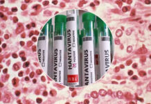 Govt says no hantavirus outbreak, increases screening Govt says no hantavirus outbreak, increases screening