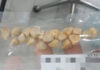 Can Thai iced tea cause gallstones? Viral post highlights unclear health claim