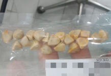 Can Thai iced tea cause gallstones? Viral post highlights unclear health claim