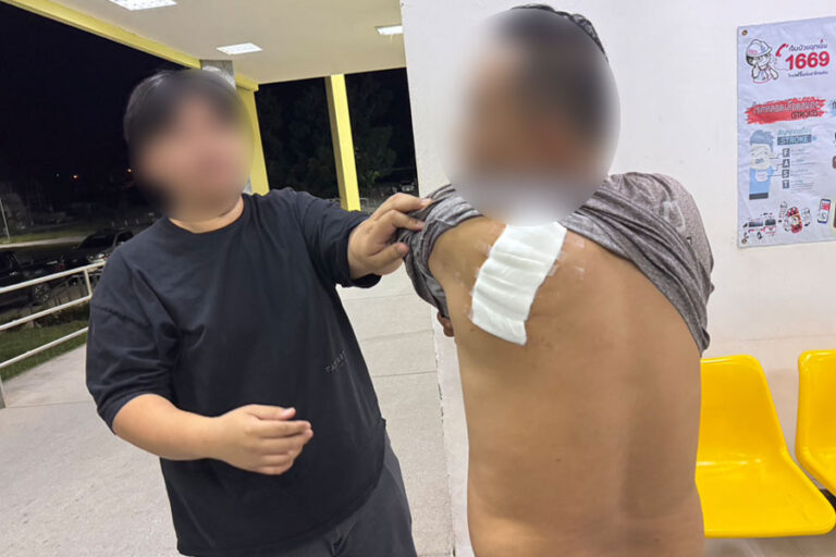 A victim of the attack shows the bandaged wounds on his back