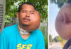 Man with severe facial swelling seeks help amid AI claims Man with severe facial swelling seeks help amid AI claims