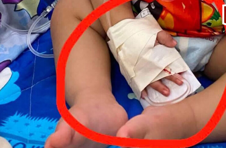 One-year-old loses finger in alleged hospital scissors mishap One-year-old loses finger in alleged hospital scissors mishap