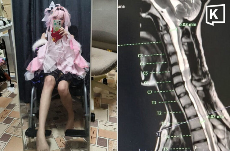 “We genuinely need these toilets”: Disabled woman shares life after illness