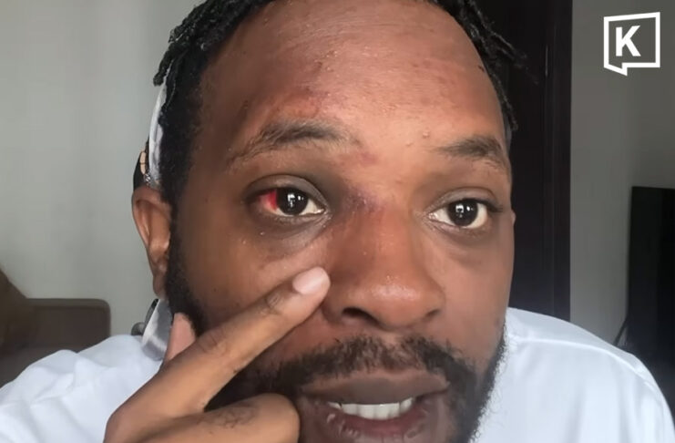 American YouTuber shows CCTV saying he was assaulted and robbed in Pattaya