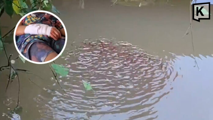 13-year-old boy attacked by giant snakehead fish while playing with fry 13-year-old boy attacked by giant snakehead fish while playing with fry