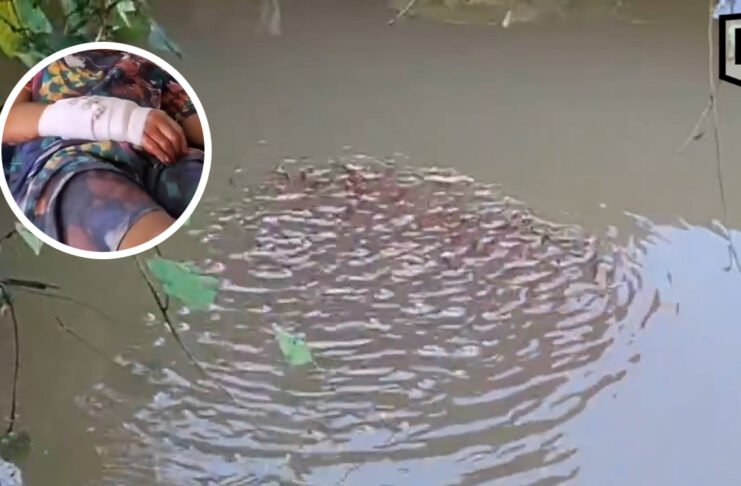 13-year-old boy attacked by giant snakehead fish while playing with fry 13-year-old boy attacked by giant snakehead fish while playing with fry