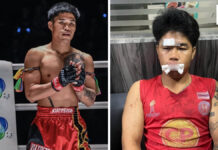 Boxer alleges two men blocked his car and beat him in Chiang Mai Boxer alleges two men blocked his car and beat him in Chiang Mai