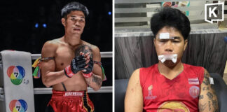 Boxer alleges two men blocked his car and beat him in Chiang Mai Boxer alleges two men blocked his car and beat him in Chiang Mai