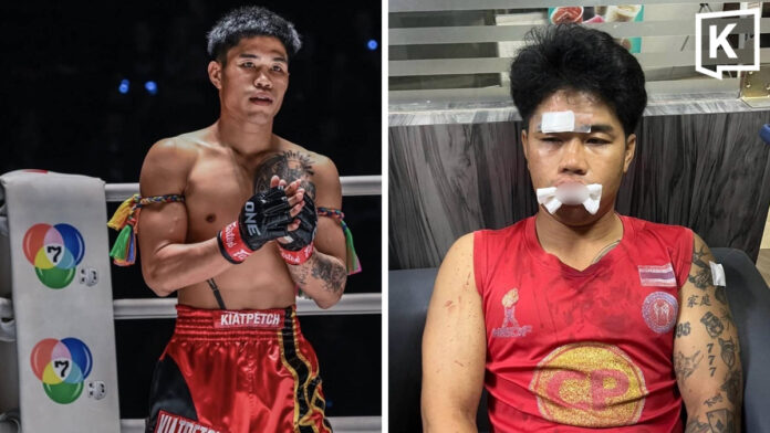 Boxer alleges two men blocked his car and beat him in Chiang Mai