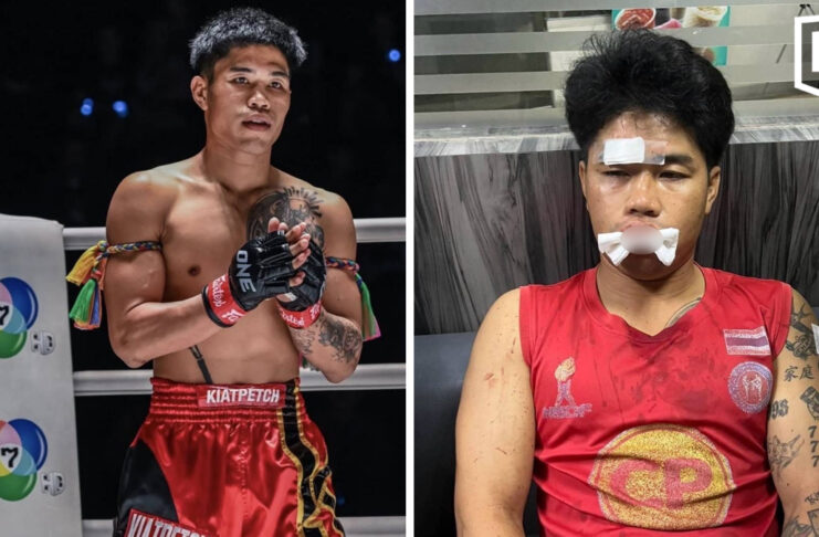 Boxer alleges two men blocked his car and beat him in Chiang Mai Boxer alleges two men blocked his car and beat him in Chiang Mai