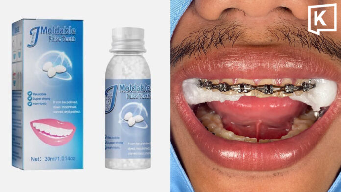 Patient spends two hours having DIY dental silicone removed